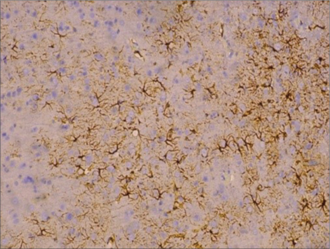 The effect of <i>Centella asiatica</i>, cinnamon, and spirulina as neuroprotective based on histopathological findings in ratus Sprague Dawley with traumatic brain injury.