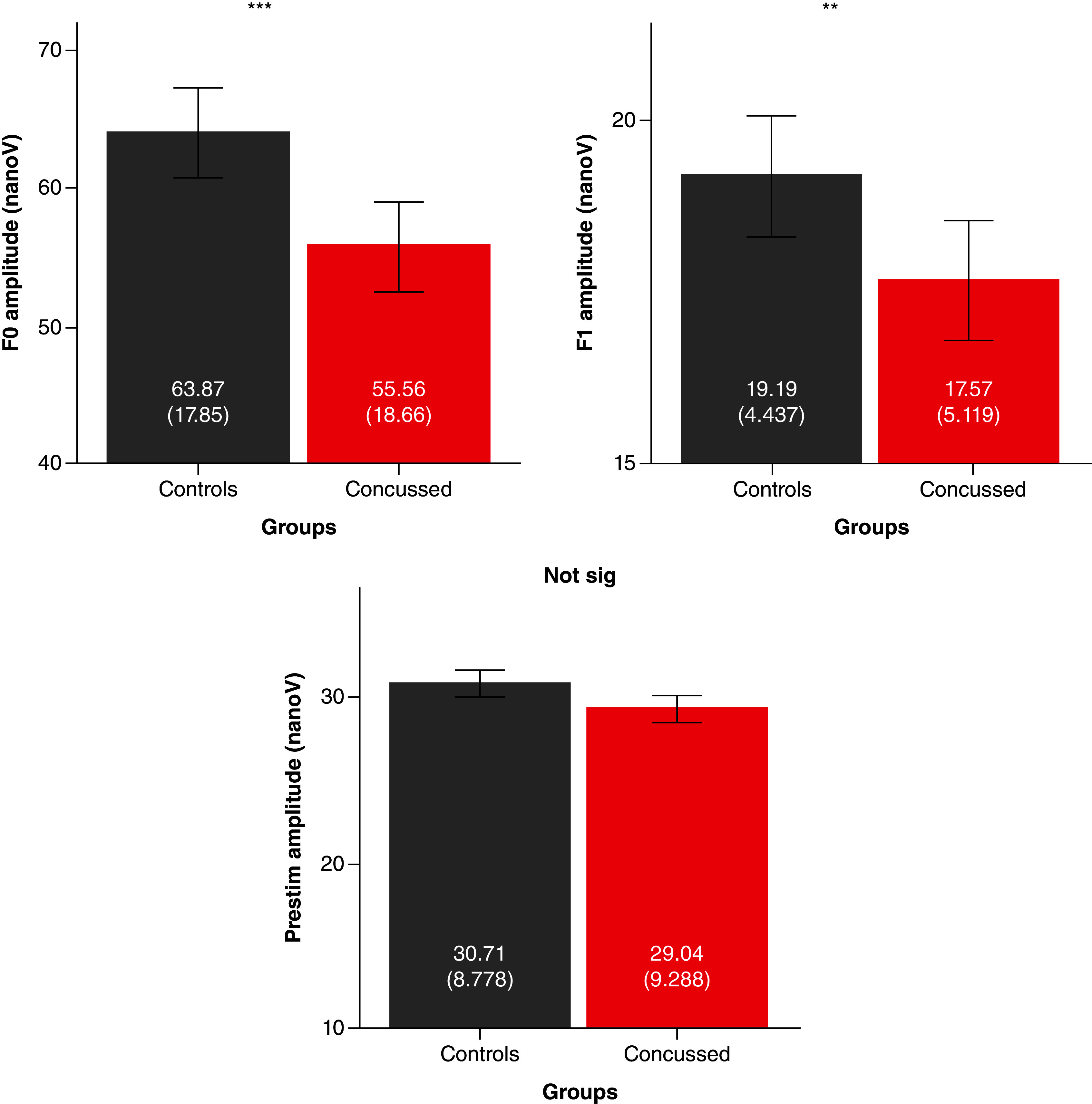 Persistent post-concussion symptoms include neural auditory processing in young children.
