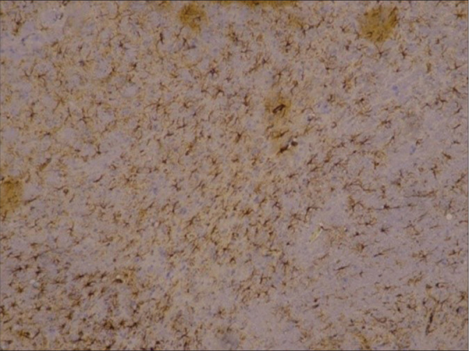 The effect of <i>Centella asiatica</i>, cinnamon, and spirulina as neuroprotective based on histopathological findings in ratus Sprague Dawley with traumatic brain injury.
