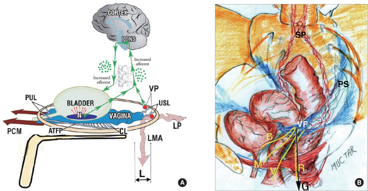 A Critical Examination of Ligamentous Pathogenesis of Bladder Pain/Lower Urinary Tract Symptoms Using the UEDA Criteria.