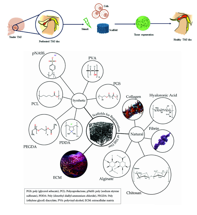 Biomimetic Scaffolds for Regeneration of Temporomandibular Joint Disc: A Narrative Review.