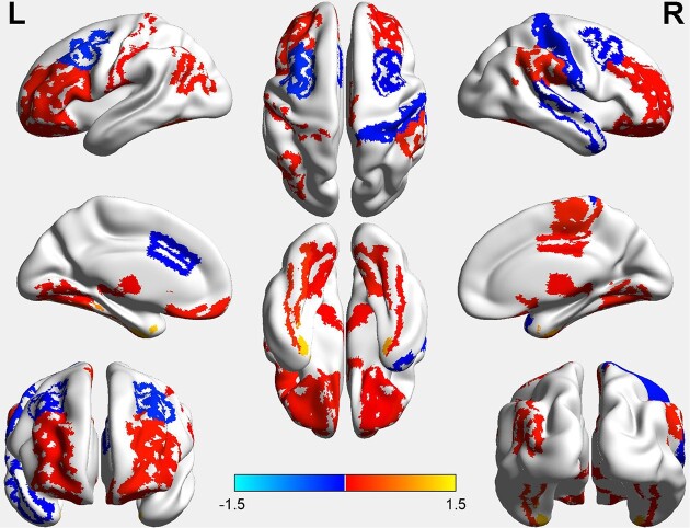 Is unilateral cerebellum sufficient? Insights from new cases of cerebellar agenesis and literature review.
