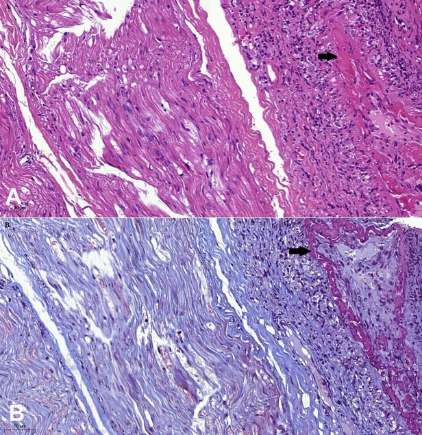 A great simulator in clinical practice: mononeuritis multiplex in HIV infection.