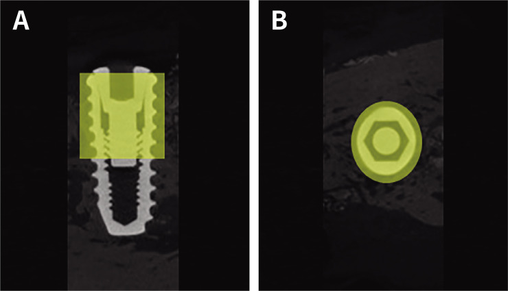 Efficacy of plasma treatment for surface cleansing and osseointegration of sandblasted and acid-etched titanium implants.