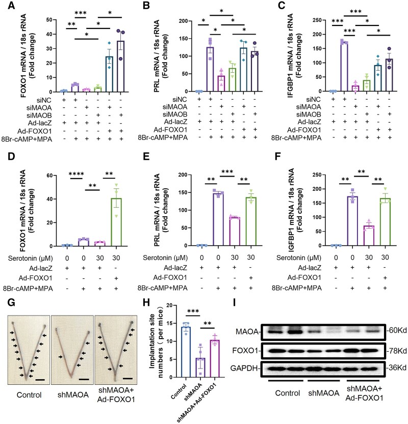Dysregulation of endometrial stromal serotonin homeostasis leading to abnormal phosphatidylcholine metabolism impairs decidualization in patients with recurrent implantation failure.