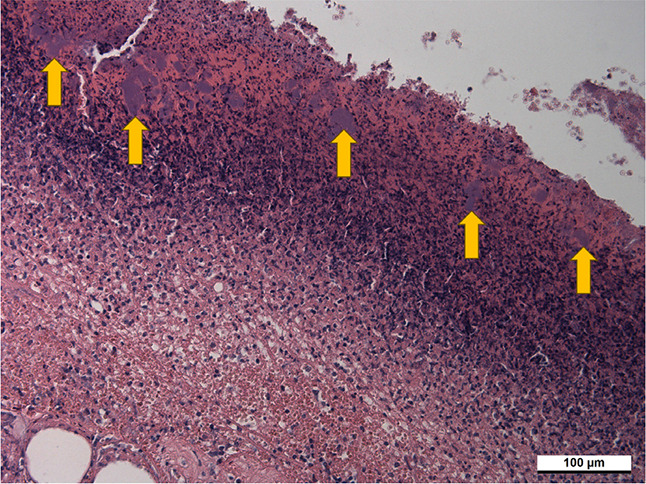 Porcine model of a complicated skin and soft tissue infection caused by <i>Pseudomonas aeruginosa</i>.