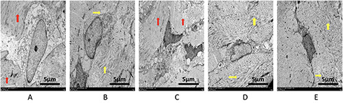 Effects of artificial light with different spectral compositions on refractive development and matrix metalloproteinase 2 and tissue inhibitor of metalloproteinases 2 expression in the sclerae of juvenile guinea pigs.