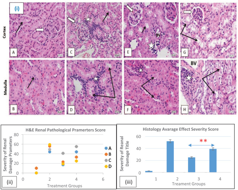 Thymoquinone Nanoparticles (TQ-NPs) in Kidney Toxicity Induced by Ehrlich Ascites Carcinoma (EAC): An In Vivo Study.