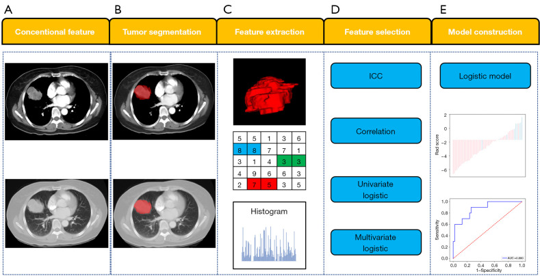 Predicting <i>MET</i> exon 14 skipping mutation in pulmonary sarcomatoid carcinoma by whole-tumour texture analysis combined with clinical and conventional contrast-enhanced computed tomography features.