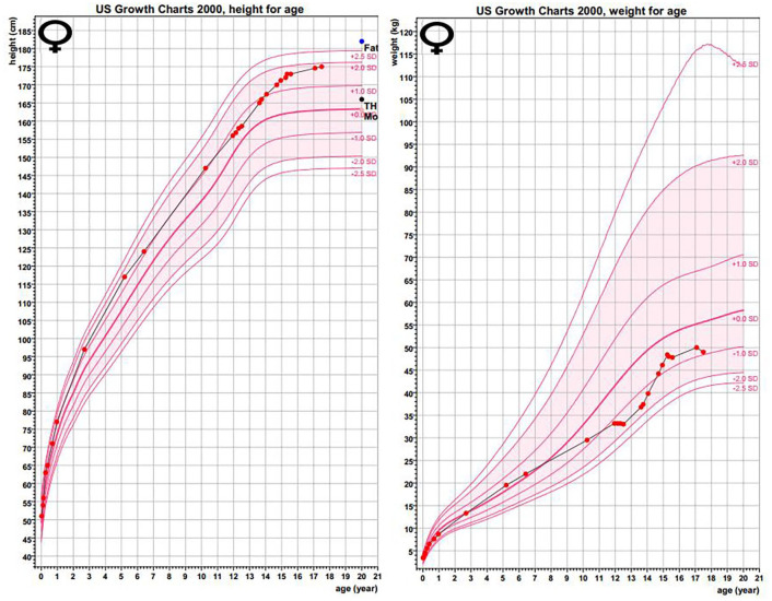 Autosomal Dominant, Long-Standing Dysglycemia in 2 Families with Unique Phenotypic Features.