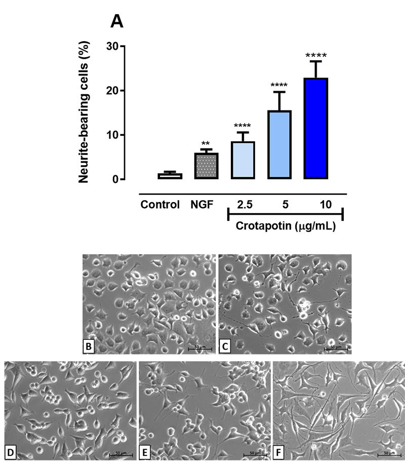 Fraction of <i>C. d. collilineatus</i> venom containing crotapotin protects PC12 cells against MPP <sup>+</sup> toxicity by activating the NGF-signaling pathway.