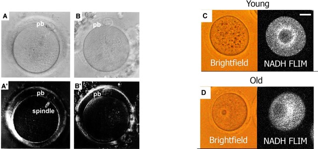 Ex ovo omnia-why don't we know more about egg quality via imaging?