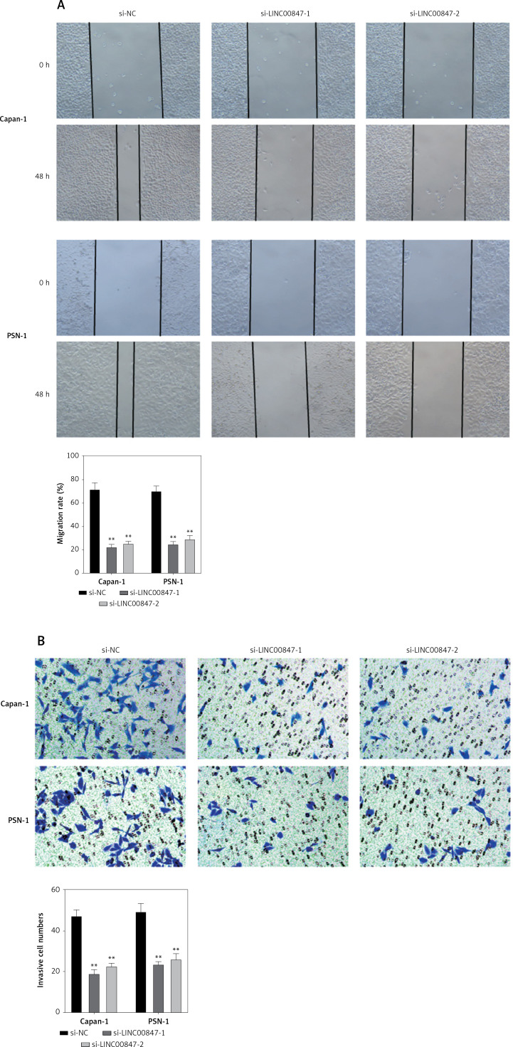 LINC00847 drives pancreatic cancer progression by targeting the miR-455-3p/HDAC4 axis.