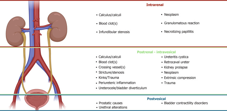 Obstructive uropathy: Overview of the pathogenesis, etiology and management of a prevalent cause of acute kidney injury.