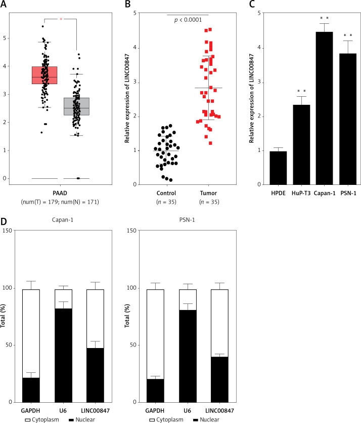 LINC00847 drives pancreatic cancer progression by targeting the miR-455-3p/HDAC4 axis.