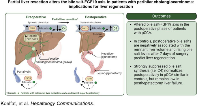 Partial liver resection alters the bile salt-FGF19 axis in patients with perihilar cholangiocarcinoma: Implications for liver regeneration.