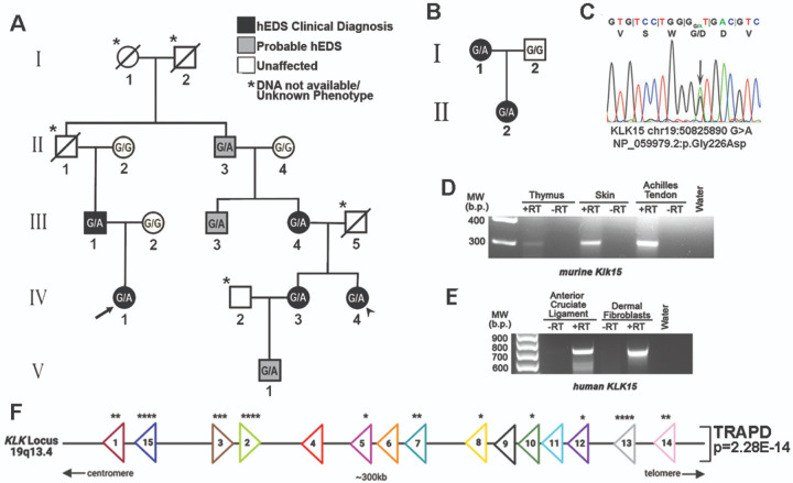 Variants in the Kallikrein Gene Family and Hypermobile Ehlers-Danlos Syndrome.