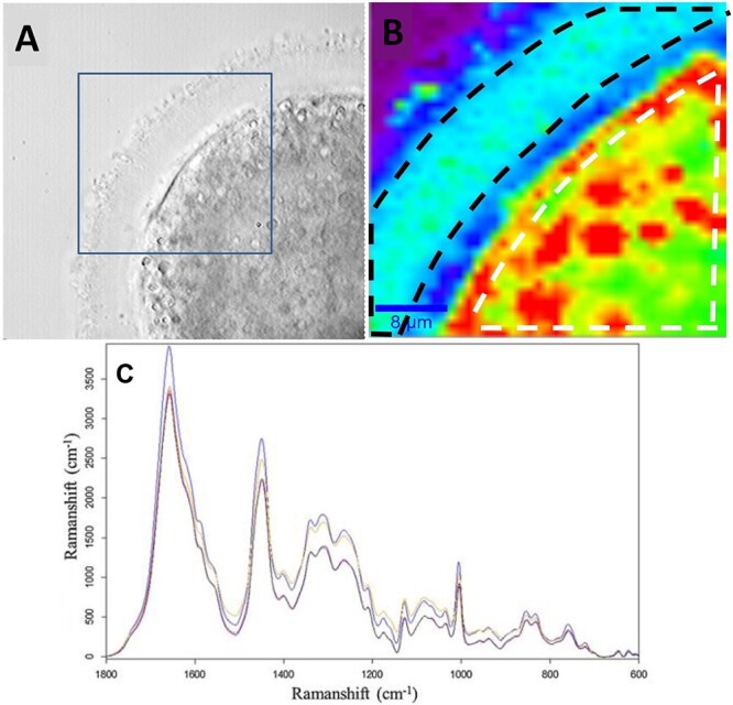 Ex ovo omnia-why don't we know more about egg quality via imaging?
