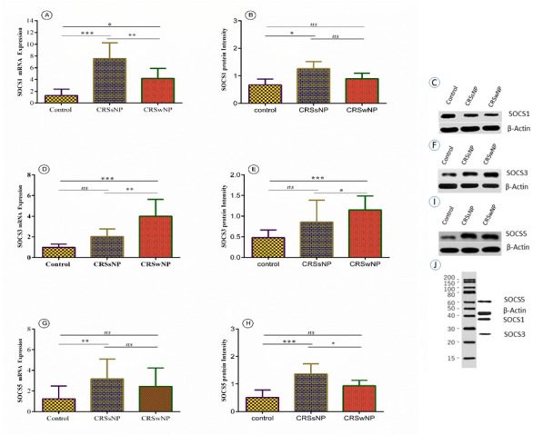 Suppressor of Cytokine Signaling Proteins 3 and 5 Potentially Delineate Polarization of Th cells in Chronic Rhinosinusitis.