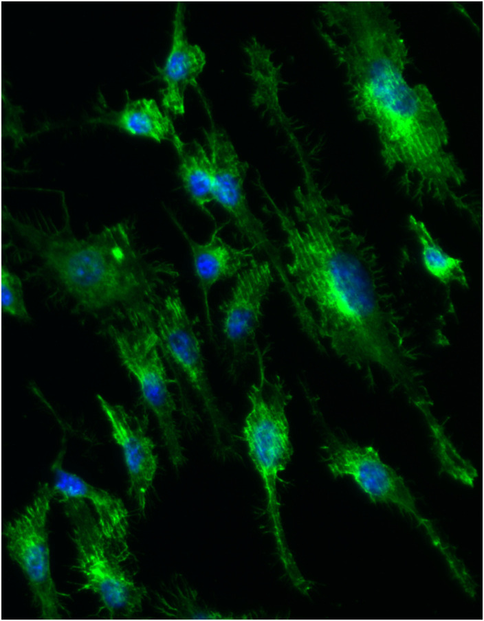 Macrophages on the wrinkle: Exploring microscale interactions with substrate topography.