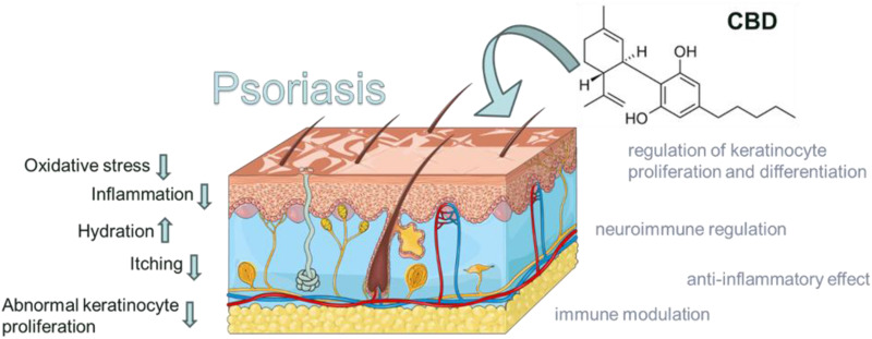 The Perspective of Cannabidiol in Psoriasis Therapy.