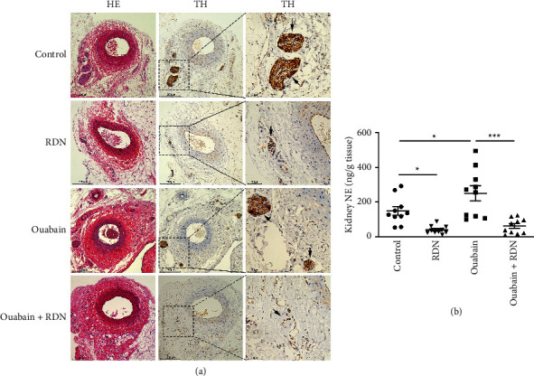 Effects of Renal Denervation on Ouabain-Induced Hypertension in Rats.