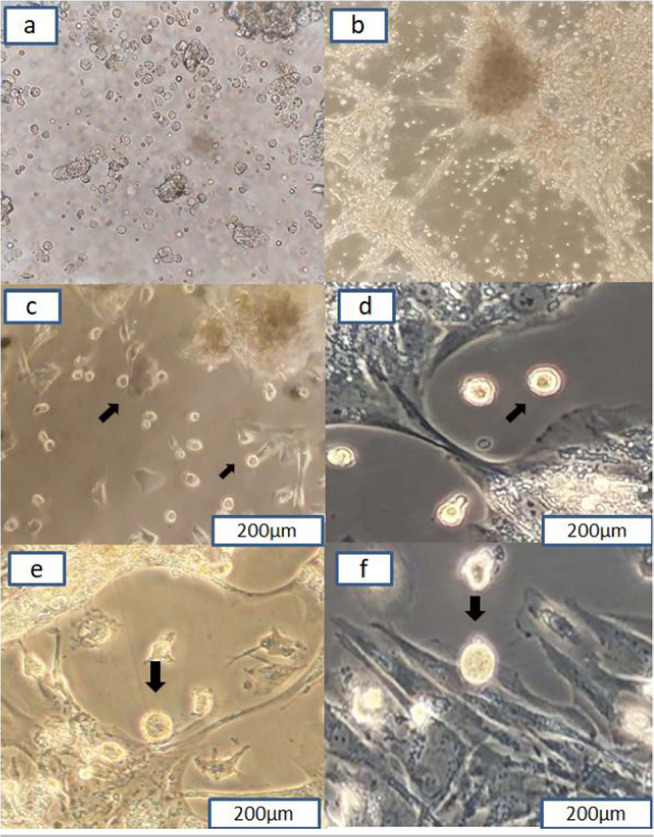 Evaluation of the expression level of microRNA-21, microRNA-15a, microRNA-372 in human follicular fluid stem cells-derived oocyte-like cells (OLCs).