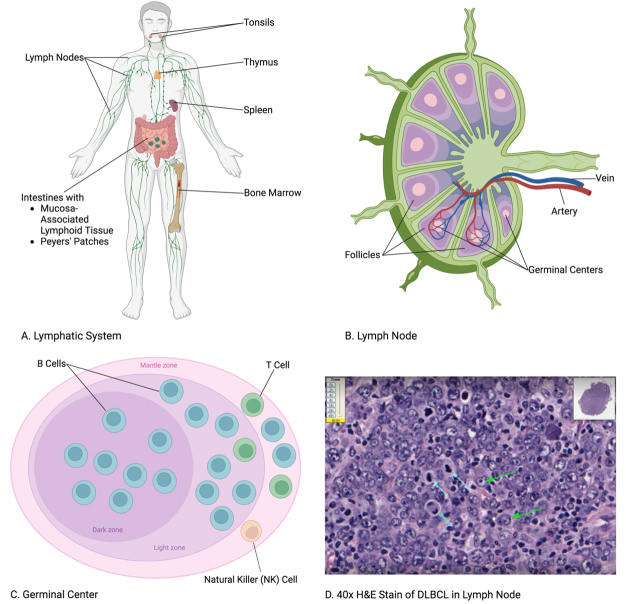 The multifaceted roles of extracellular vesicles for therapeutic intervention with non-Hodgkin lymphoma.