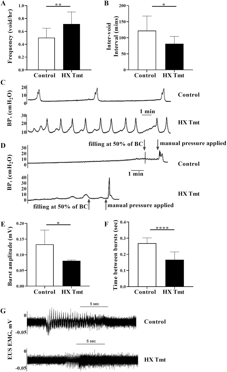 Hypoxanthine Induces Signs of Bladder Aging With Voiding Dysfunction and Lower Urinary Tract Remodeling.