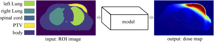 A Review of Artificial Intelligence Application for Radiotherapy.