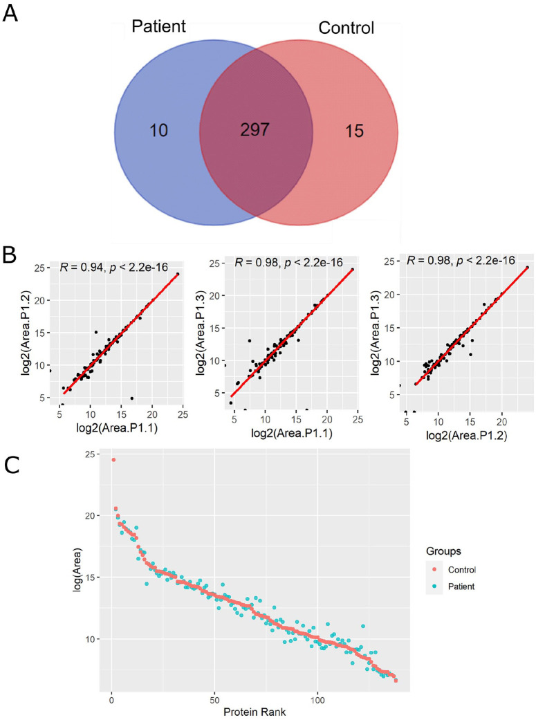 Mass Spectrometry Proteomics Characterization of Plasma Biomarkers for Colorectal Cancer Associated With Inflammation.