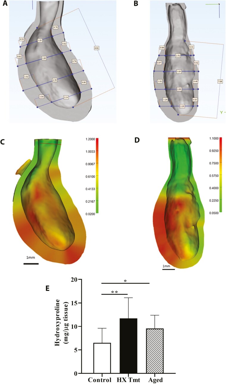 Hypoxanthine Induces Signs of Bladder Aging With Voiding Dysfunction and Lower Urinary Tract Remodeling.