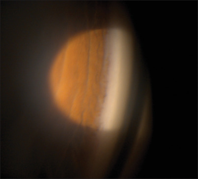 Abstract Image