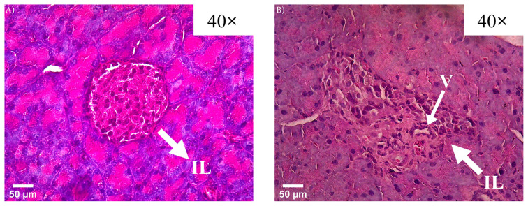 Exploring the impact of diabetes on aging: insights from TERT and COL1A1 methylation.