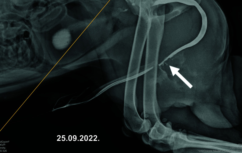 Stone-induced urethral fistula treatment with microfragmented adipose tissue containing mesenchymal stem cells: a case report from veterinary medicine with potential application in humans.