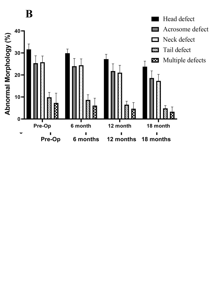 The Effects of Varicocelectomy on Sperm DNA Fragmentation and Conventional Semen Parameters in Men with Severe Oligoasthenoteratozoospermia: A Prospective Study.
