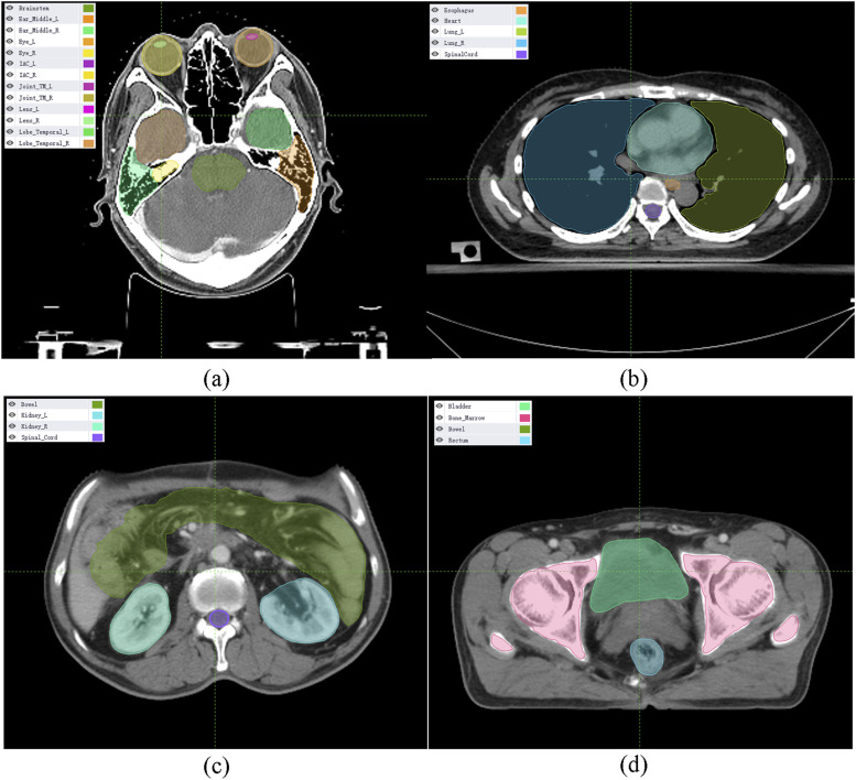 A Review of Artificial Intelligence Application for Radiotherapy.