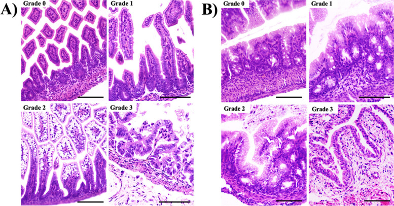 Cannabidiol decreases histological intestinal injury in a neonatal experimental model of necrotizing enterocolitis.