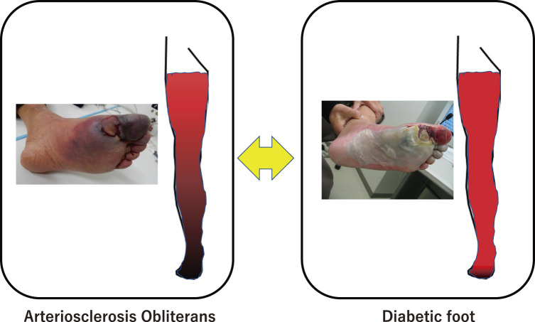 Vascular Disease and Diabetes.