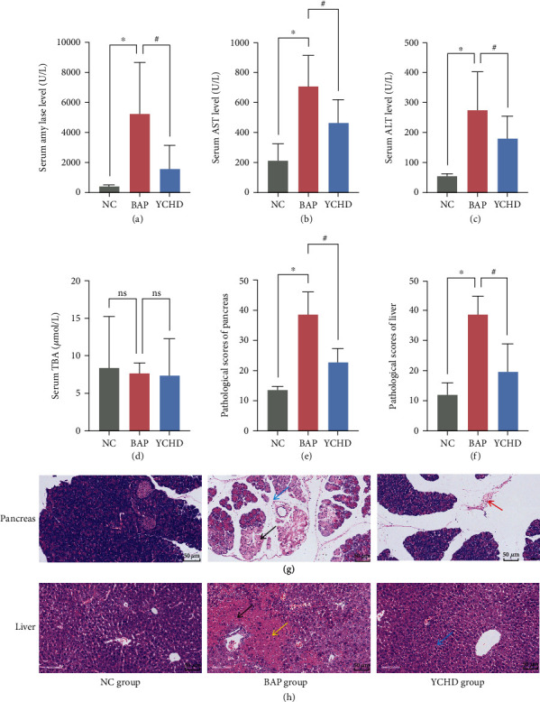 Yinchenhao Decoction Protects Against Acute Liver Injury in Mice With Biliary Acute Pancreatitis by Regulating the Gut Microflora-Bile Acids-Liver Axis.