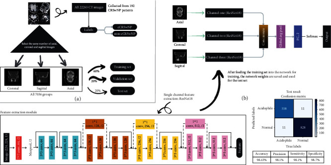 An End-to-End CRSwNP Prediction with Multichannel ResNet on Computed Tomography.