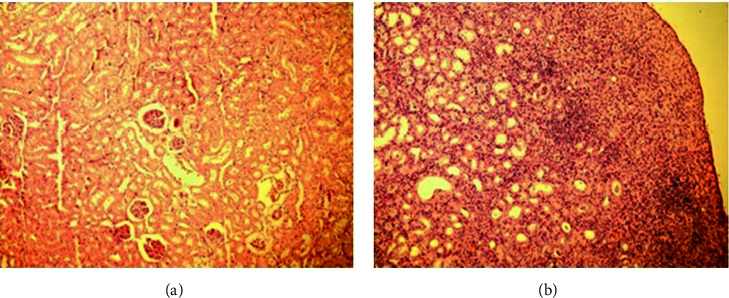 Effects of the Surgical Ligation of the Ureter in Different Locations on the Kidney over Time in the Rat Model.