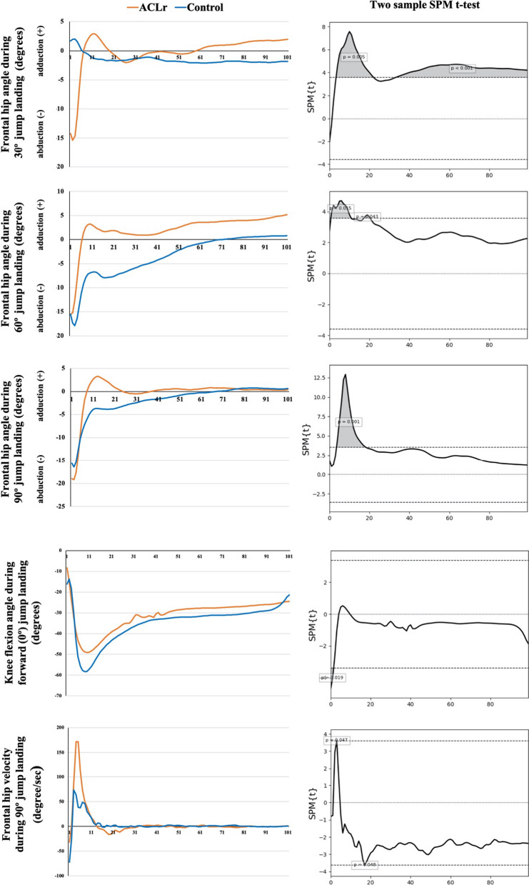 Residual deficits of knee and hip joint coordination and clinical performance after return to sports in athletes with anterior cruciate ligament reconstruction.