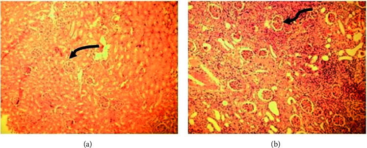 Effects of the Surgical Ligation of the Ureter in Different Locations on the Kidney over Time in the Rat Model.