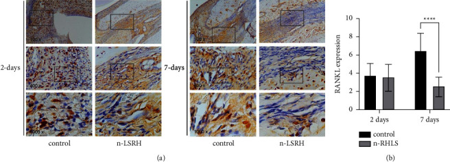Nanoparticle-Based Rice Husk Liquid Smoke as Periodontitis Therapy through OPG, RANK, and RANKL Expression.