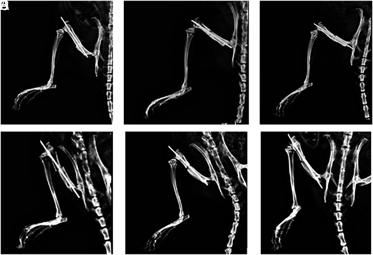 The effect of favipiravir on fracture healing.