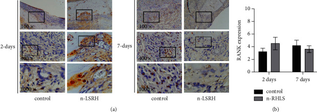 Nanoparticle-Based Rice Husk Liquid Smoke as Periodontitis Therapy through OPG, RANK, and RANKL Expression.