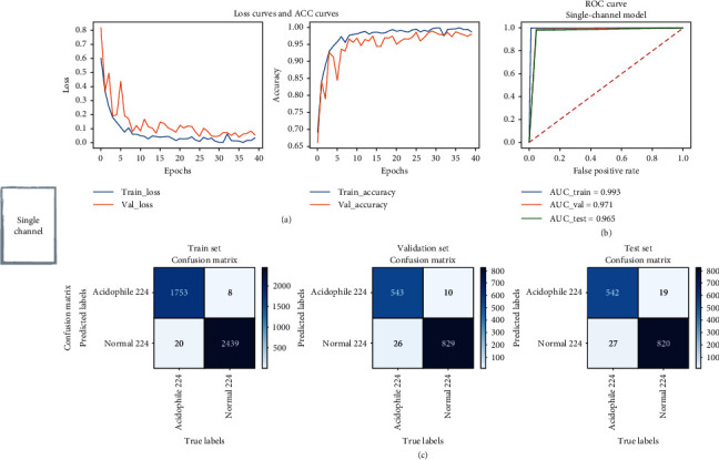 An End-to-End CRSwNP Prediction with Multichannel ResNet on Computed Tomography.