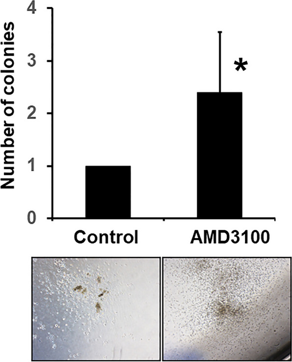 Potentiating effect of AMD3100 on bone morphogenetic protein-2 induced bone regeneration.