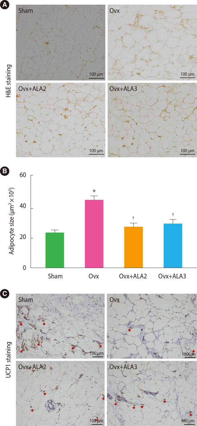 Alpha-Lipoic Acid Induces Adipose Tissue Browning through AMP-Activated Protein Kinase Signaling <i>in Vivo</i> and <i>in Vitro</i>.